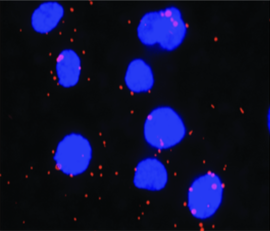 Fluorescence micrograph of blue-stained nuclei with red HBeAg and TLR4 puncta.